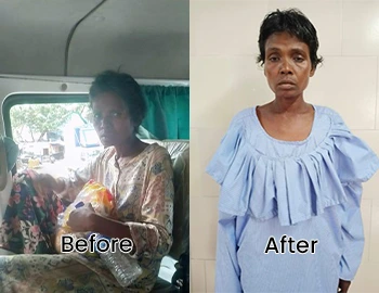 Before and After Image