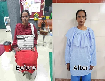 Before and After Image