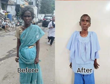Before and After Image
