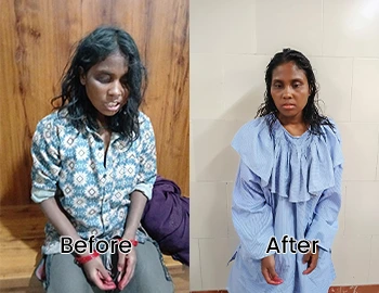 Before and After Image